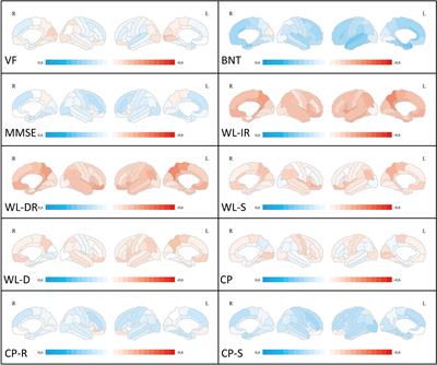 Regional Cerebral Associations Between Psychometric Tests and Imaging Biomarkers in Alzheimer’s Disease